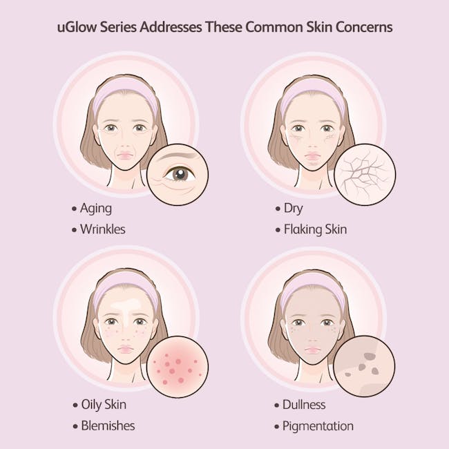 OSIM uGlow Eye Beauty Series - 8